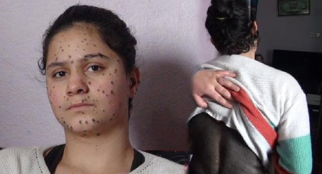 13 yaşındaki kız tedavi olmak istiyor
