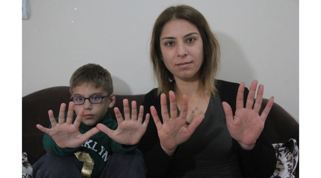 24 parmaklı çocuk