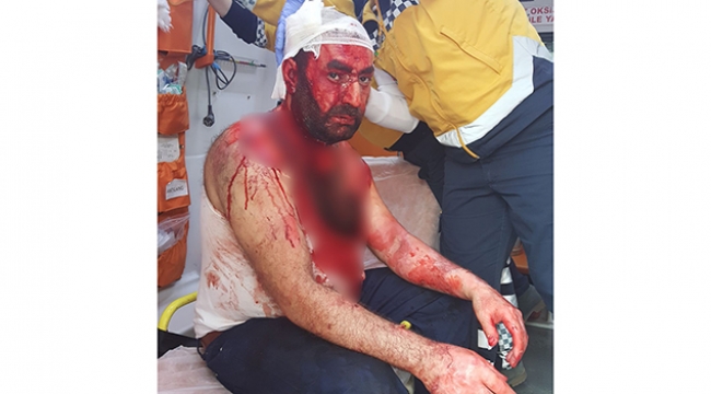 Boşandığı kocasına kızgın yağ döken kadının cezası bozuldu