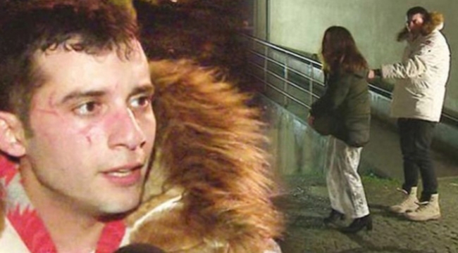Fırat Altunmeşe sevgilisiyle tekme tokat birbirine girdi