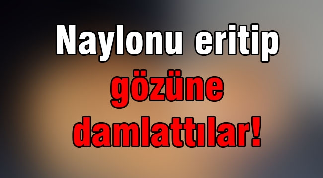 Naylonu eritip gözüne damlatmışlar!