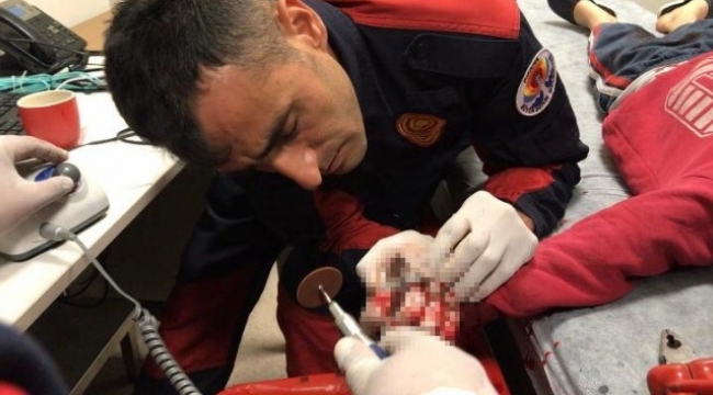 Metale parmağı sıkışan çocuğu Cankur kurtardı
