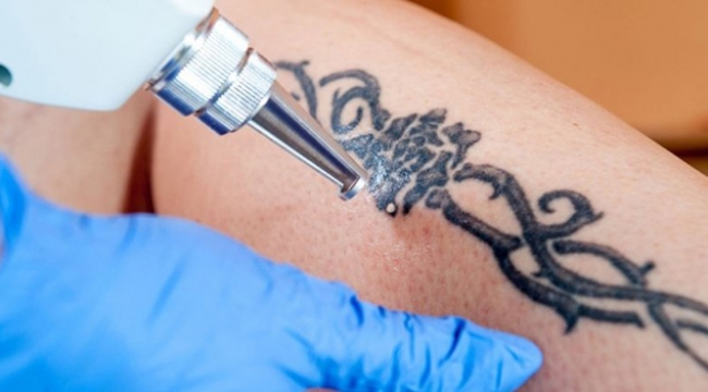 Kalıcı dövme ve piercinglerde hepatit riski