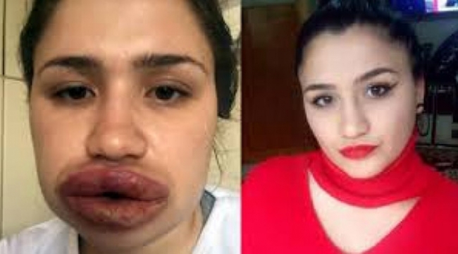 Sahte estetikçi kuaför sır oldu