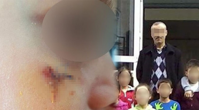 1. sınıf öğrencisini kitapla yaralayan öğretmene ceza