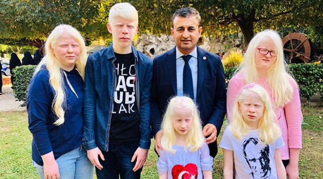 Bulut, albino olan çocuklarla ve aileleriyle bir araya geldi