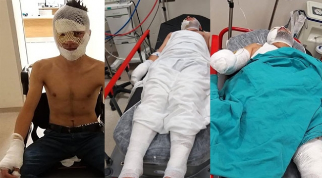 Evi yakmak isterken kendilerini yaktılar