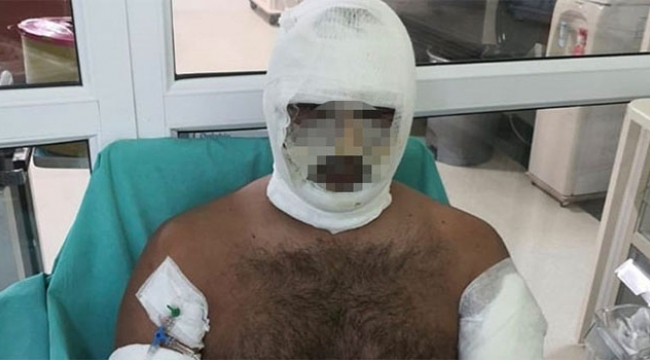 Kebapçıda fırın patladı sahibi ağır yaralandı