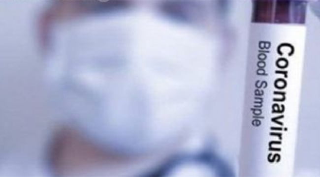 Yeni korona virüsünde vaka sayısı 64 bin 627'ye çıktı