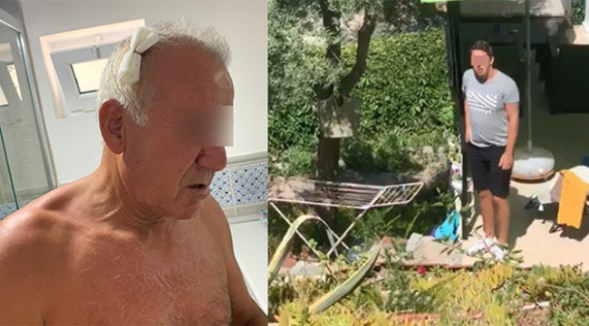 Kiracı baba ile oğlunun saldırısına uğradı