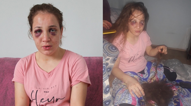 Düşmanı değil kocası bu hale getirdi