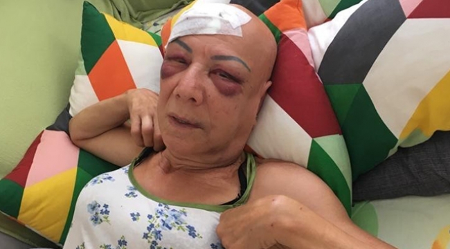 Kayınvalidesini vuran damada istenen ceza...