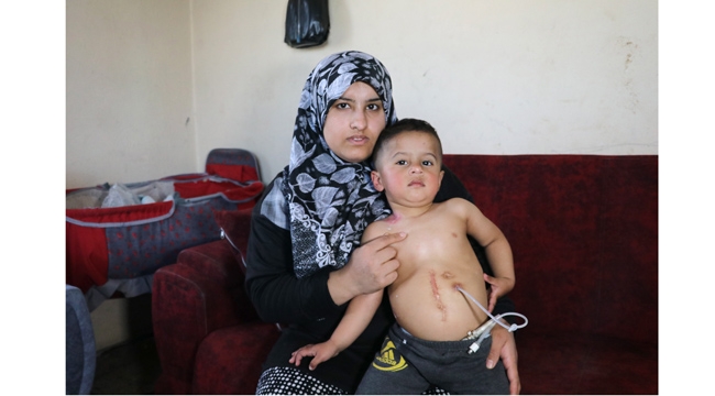 Yemek borusu olmayan Muhammed yardım bekliyor