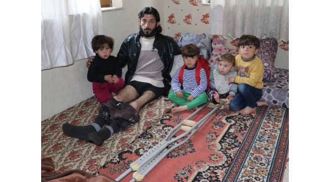 Savaşın izini vücudunda taşıyor