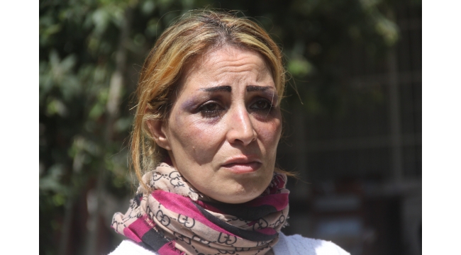  İranlı mimar çöpten çimento üretmek için destek bekliyor