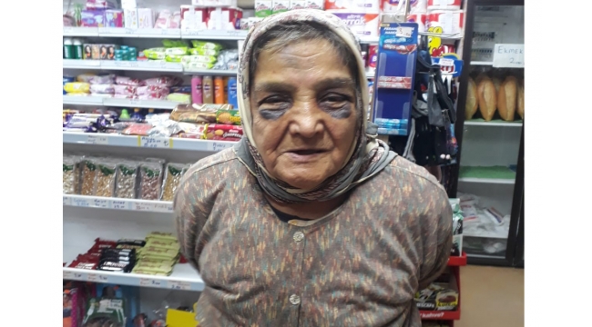 Eşini darp eden koca hakkında yasal işlem başlatıldı!