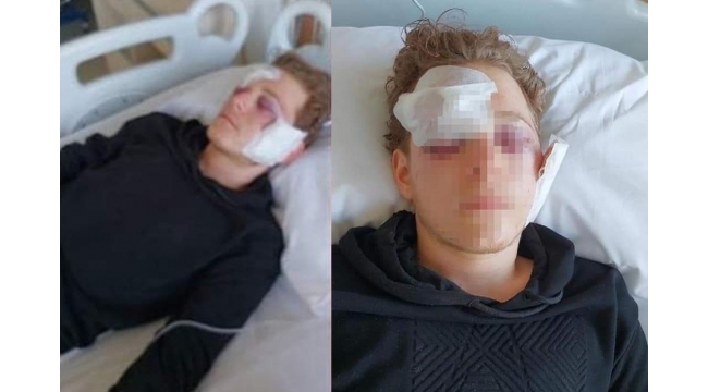 Liseli gencin silahla oyunu kanlı bitti!