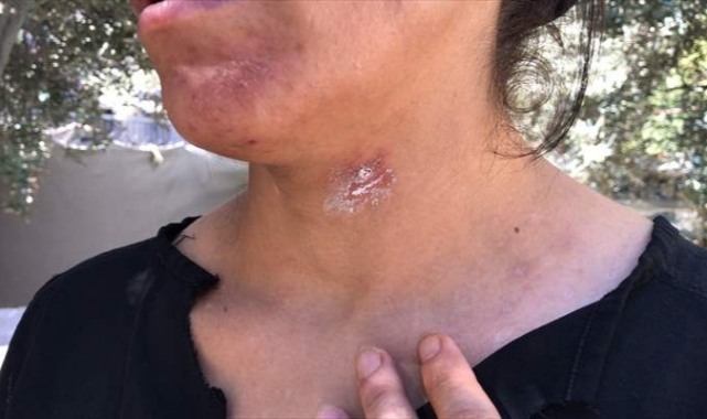 Kadını ve bebeğini darp etti, evi ateşe verip kayıplara karıştı!