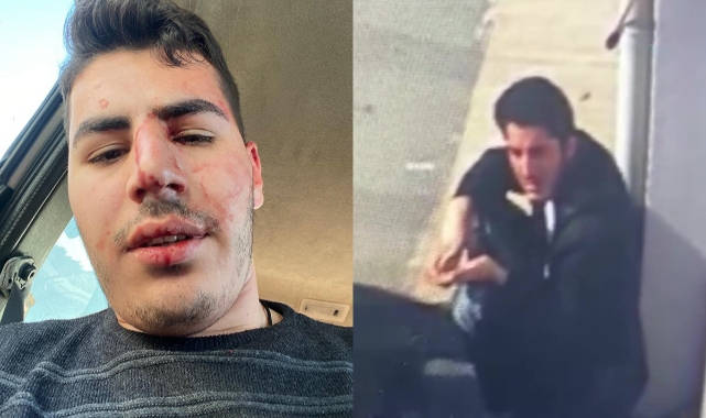 ''Kız arkadaşıma baktın'' diyen müşterinin saldırısına uğradı!
