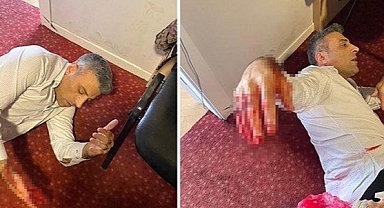 YP Genel Başkanına bıçaklı saldırı!