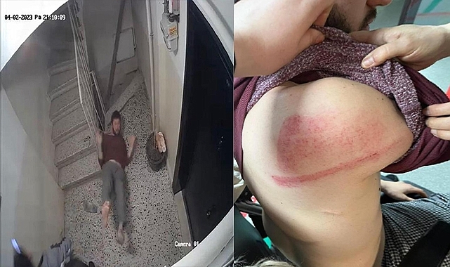 Ev Sahibinin Kardeşi ve Arkadaşı Kiracıyı Tekme Tokat Dövdü!