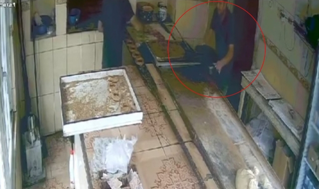 Kızgın Pekmezle Kendini Yaktı!