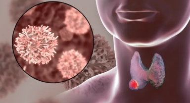 Tiroid Kanseri Sessiz İlerliyor: Belirtileri ve Tedavi Yöntemleri Neler?