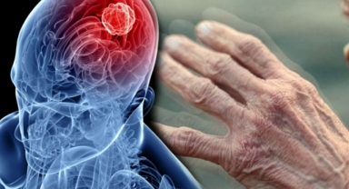 Hava Kirliliği Ve Böcek İlaçları Parkinson Riskini Artırıyor