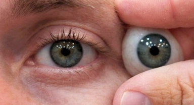 Protez Göz Mucizesi