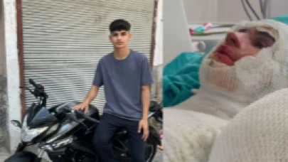 Vicdansız Amca! Yanıcı Madde Döküp, Yeğenini Yaktı