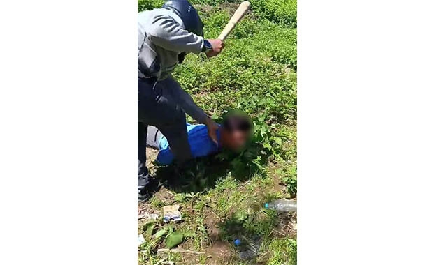 Sopalı Saldırgan Gözaltına Alındı