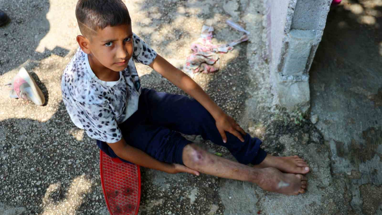 11 Yaşındaki Serdal'ın Ağır Yükü:Hayatı Kaykay Üzerinde Geçiyor