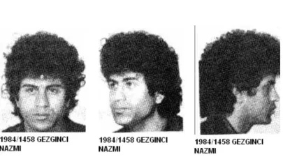 Gözünün Altındaki İz Detayıyla Yakalandı