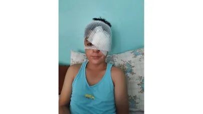 Kaçarken Otomobil Çarptı