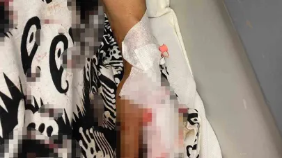 Abdest Alacaktı Köpekler Saldırdı