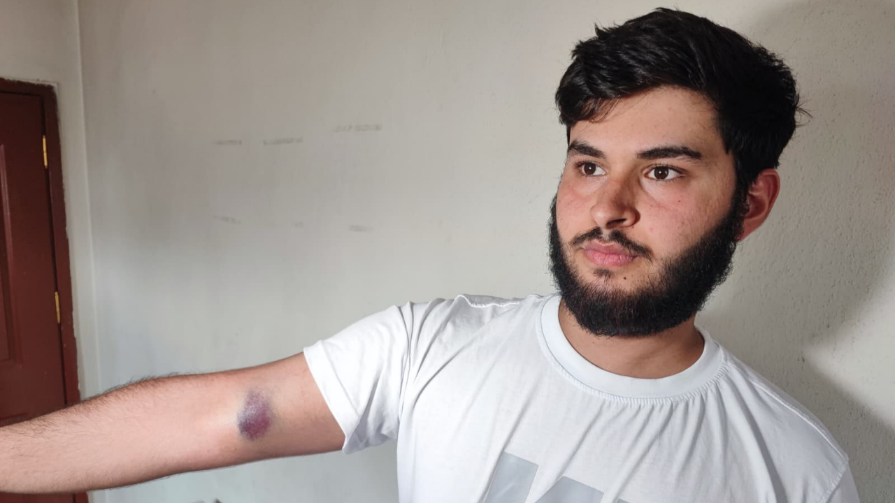 Adana'da Cono Dehşeti:Sopa ve Silahla Saldırdılar