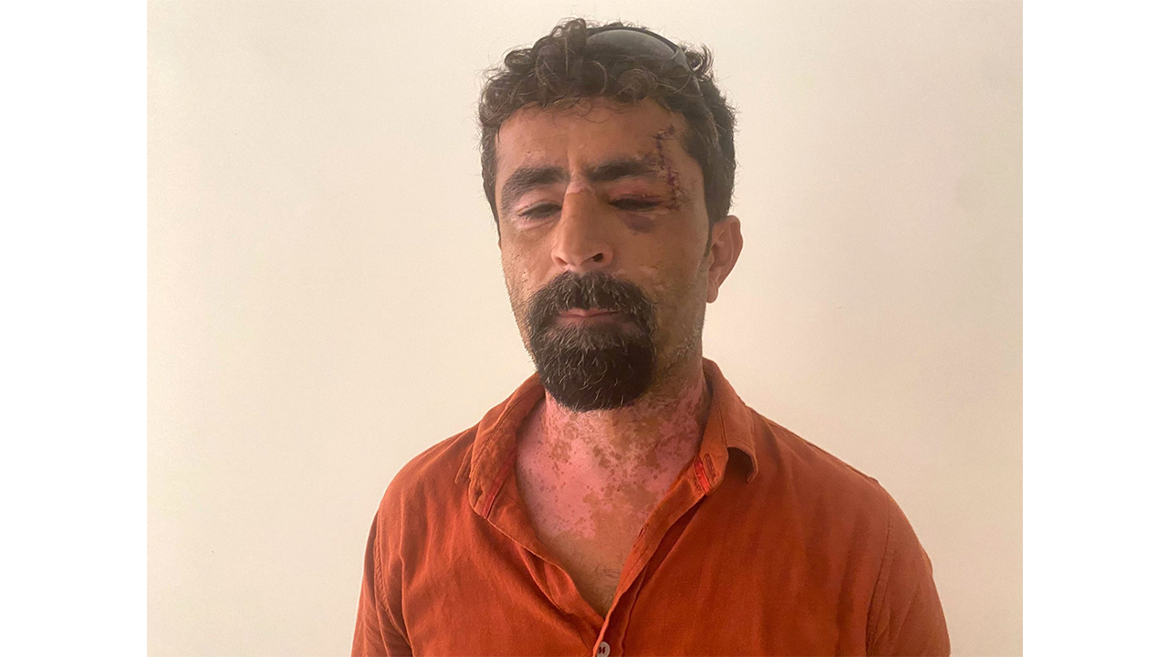 Öfkeli Damat Kayınpederini Hastanelik Etti
