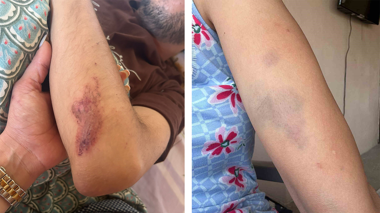 ''Sokak Köpeklerini Besledin'' İddiasıyla Darp!
