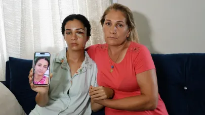 Eski Eş Dehşeti! ''Yaşarken Kurtulayım''