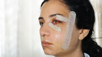 Eski Eşini Dövüp Serbest Kalan Şüpheli Tutuklandı