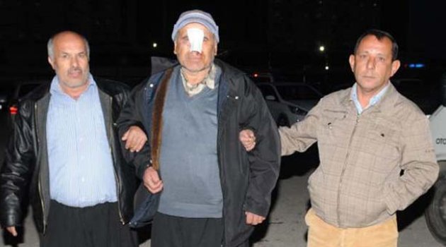 5 hastane dolaştı ama burnundaki yaraya dikiş attıramadı