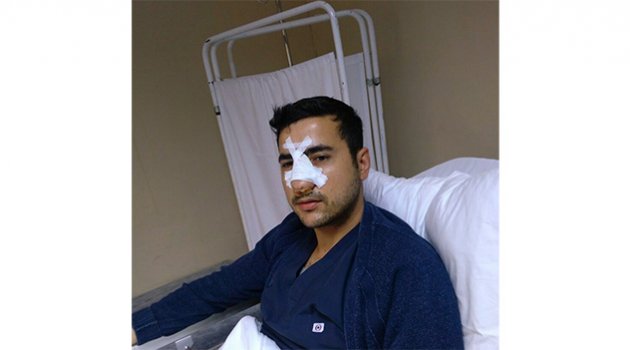 Acil serviste sağlık memurunun burnunu kırdı