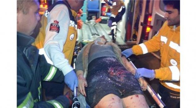 Adana’da Direksiyon Hakimiyetini Kaybeden Otomobil, Park Halindeki Kamyonetlere Çarptı: 1 Kişi Ağır Yaralı