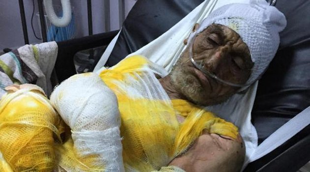 Alevler arasında kalıp ağır yaralandı