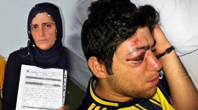 Bekçinin zihinsel engelli oğluna polisten dayak