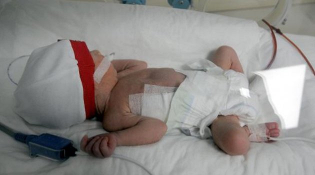 Bir günlük bebeğe yemek borusu ameliyatı