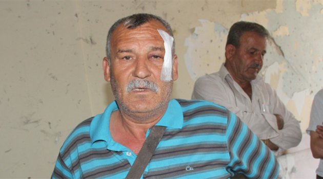 Bombalı saldırıda yaralanan eski başkan yaşadıklarını anlattı