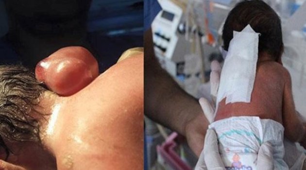 Böyle doğum görülmedi