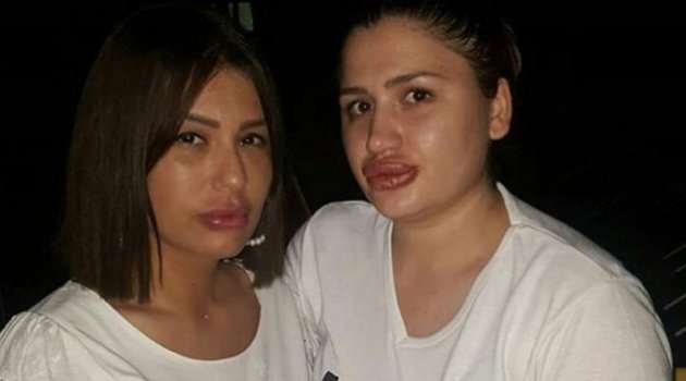 Bu dudaklara 12 yıl istendi