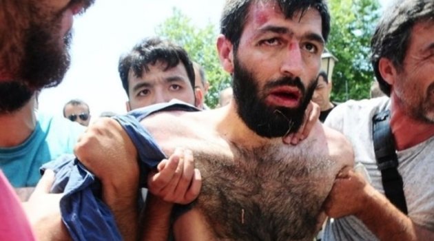 ‘Canlı Bombanın’ akli dengesi yerinde mi?